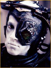 Implant oculaire Borg